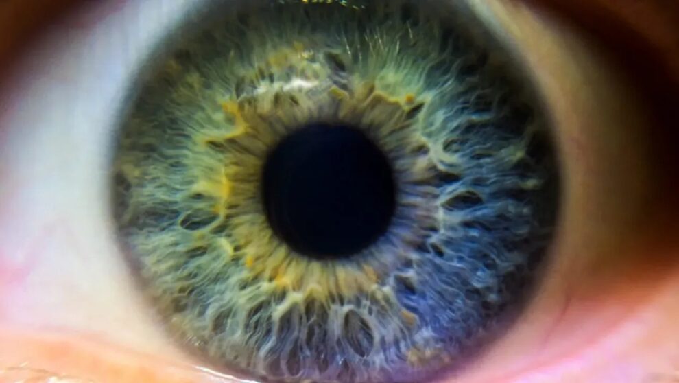 Can LASIK Alter the Color of Your Eyes? Close up of an eye